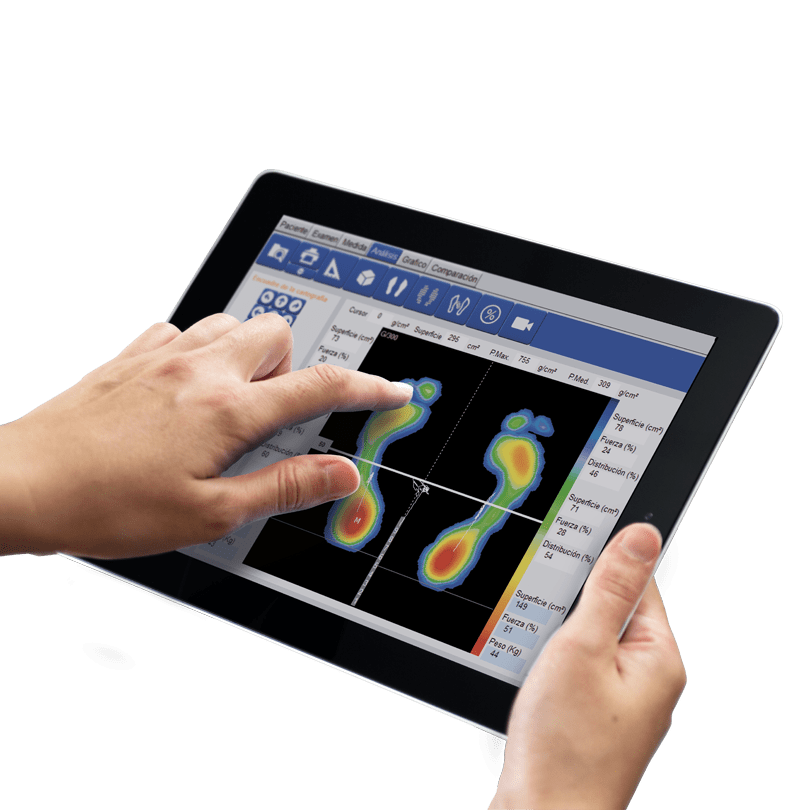 Podoprint Wifi I Plataforma de Presiones I Namrol